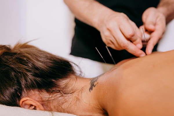 acupuncture-2